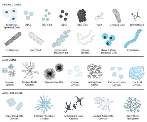 veterinary urine sediment guide